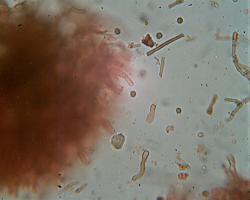 Corticiacea ospitale